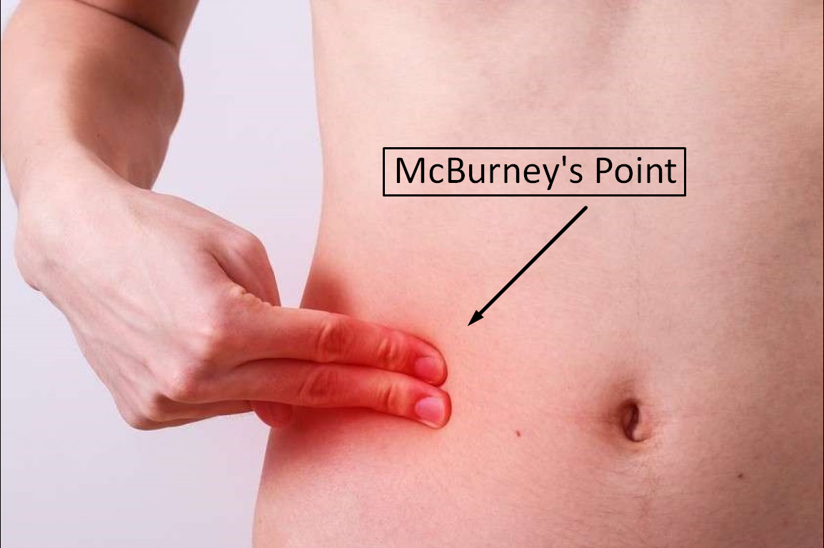 Mcburneys point